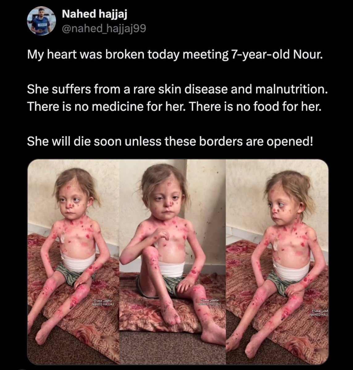 Where is the conscience of the world?