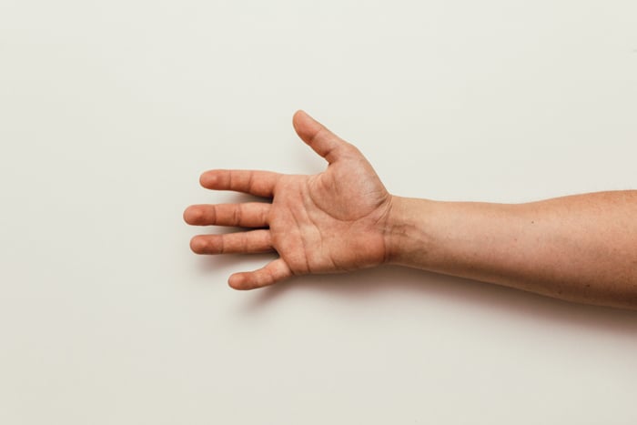 arm