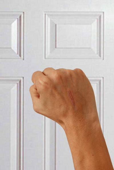 scarred hand knocking on door