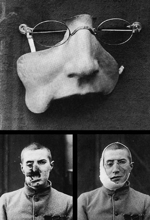 Proteser från första världskriget