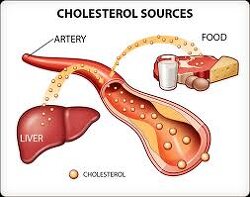 What are your thoughts on cholesterol? Healthcare lies about Cholesterol. Cholesterol isn’t a bad thing. It is the size of the triglycerides that matter. Cholesterol is directly converted into testosterone and estrogen, which are essential to human function.
