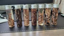 These are fibrous clots taken out of 7 different people from their arteries. As John O’Looney says, these are people murdered by the state.