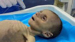 ONLY ONE SIDE [Israel] STARVES BABIES.