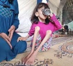 GAZA CHILDREN ARE STARVING. If you see this little angel,  pray for her.