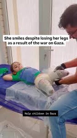 What a beautiful girl. Israel not only murdered 50000+ children but also made so many of them permanently injured.