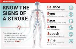 Important: Signs of a stroke.
