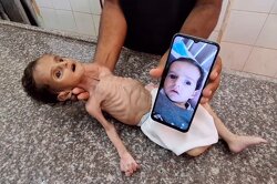 It is anti-Semitic to denounce the genocide.