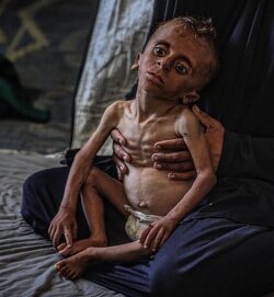 14 Palestinians, including two children, died of starvation and malnutrition in the past 24 hours, raising the total famine-related death toll to 147, including 88 children. Gaza has become the hungriest place on earth.