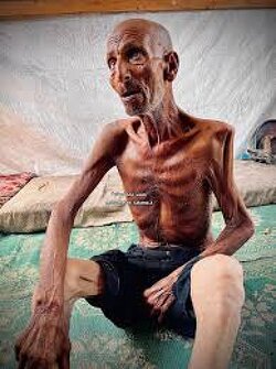 Salim Asfour, 75, from Abasan, Khan Yunis, survives on stale bread soaked in water.  After 4 months of starvation, he’s lost his vision and use of his legs. Israeli forces destroyed his home. “There is no food, no drink, nothing.”
