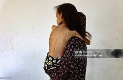 Her name is Mariam, 9 years old, from Gaza.  Israel is starving her.