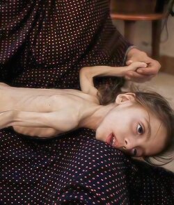 Starvation is taking the lives of the  children in Gaza, while you indulge in luxury. If this child were your own, would you dare to remain silent?