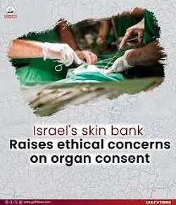 Isræl has one of the world’s largest skin banks in the world. How?