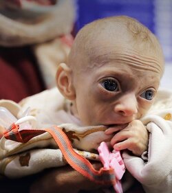 Gaza is starving.