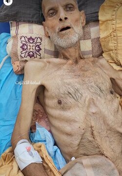 While the world is powerless to force Israel to stop the genocide, people are dying from hunger in Gaza.