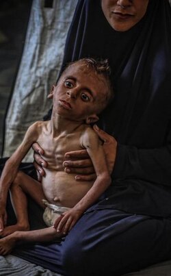 How can the world remain silent in the face of the hunger and genocide carried out by Israel in Gaza?