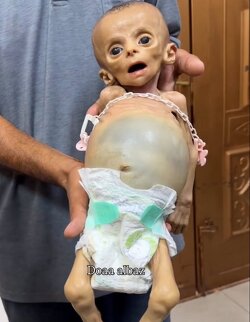 Your tax dollars are fueling the monstrous cruelty of the State of Israel, condemning this helpless infant to die a slow, agonizing death by hunger.