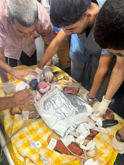 This baby was quickly removed from his mother's womb by emergency caesarean section in the emergency room by emergency room doctors. After the enemy bombed their tent, the mother was immediately martyred. The father was also martyred. The baby was quickly admitted to the nursery. Another baby is the only survivor.