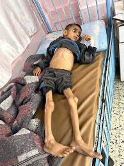 May the eyes of starving children haunt us all.