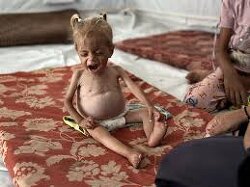 SHOW ME ONE STARVING ISRAELI BABY.  YOU CANT. YOU CANT EVEN LOOK AT THIS STARVING PALESTINIAN BABY BECAUSE YOU ARE NOT EVEN HUMAN.